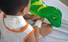 Bé 4 tuổi bị chó Becgie tấn công, được cấp cứu kịp thời