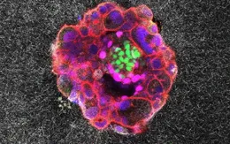 Lần đầu tiên ghi lại quá trình cấy ghép phôi người vào tử cung