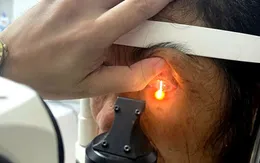 Người phụ nữ suýt hỏng mắt vì dùng hạt na ngâm rượu gội đầu trị chấy