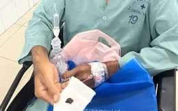 Ho kéo dài suốt 1 năm, phát hiện mảnh vỏ ốc mắc trong phế quản