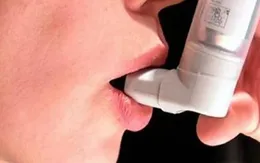 Hen phế quản - bệnh mạn tính nguy hiểm cần kiểm soát chặt chẽ