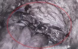 7 năm rong ruổi tìm bệnh của chàng trai mắc hội chứng cực hiếm