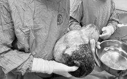 Em bé chào đời còn nguyên trong bọc ối tại Quảng Ninh