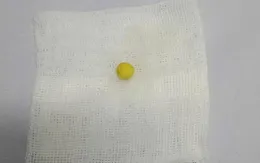 Nguy kịch vì hóc dị vật đường thở