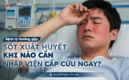 Sốt xuất huyết - khi nào cần nhập viện cấp cứu ngay?