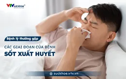 Các giai đoạn của bệnh sốt xuất huyết