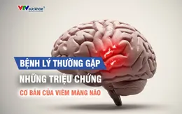 Những triệu chứng cơ bản của viêm màng não