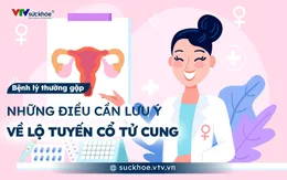 Những điều cần lưu ý về lộ tuyến cổ tử cung