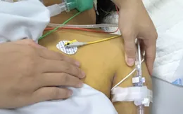 Cảnh báo nguy cơ mắc xoắn khuẩn vàng da mùa mưa lũ