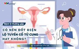 Có nên đốt điện lộ tuyến cổ tử cung hay không?