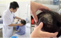 Cảnh báo tai nạn sinh hoạt ở trẻ nhỏ