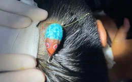 Cẩn trọng tai nạn thương tích ở trẻ khi đi câu cá