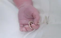 Hành trình hồi sinh kỳ diệu của em bé được cứu sống ngay từ trong bụng mẹ