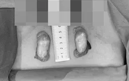 Hành trình tìm lại giới tính thật của người mang bộ gen nam trong hình hài nữ