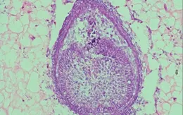 Chạy đua phát triển răng người trong phòng thí nghiệm