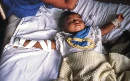 Gia tăng số ca mắc tả tại hơn 30 quốc gia, WHO cảnh báo về nguy cơ lan rộng