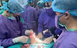 Nữ sinh 19 tuổi được "trồng" lại chân đứt rời sau tai nạn với mô tô phân khối lớn