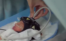 Thử nghiệm công nghệ theo dõi não bộ trẻ em tại Anh