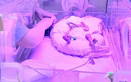 Kỳ tích sau 50 ngày hồi sinh của bé sinh non 30 tuần