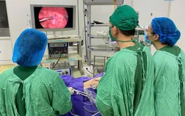 Bé trai 6 tuổi thủng hồi tràng do mảnh xương cá kích thước lớn