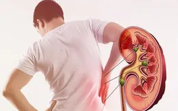 Đừng để thận "chịu trận" một mình