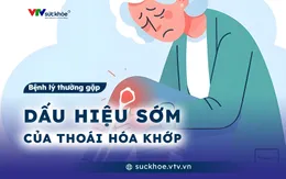 Dấu hiệu sớm của thoái hóa khớp
