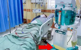 Triglycerid tăng cao gấp nhiều lần, bệnh nhân thoát nguy nhờ lọc máu