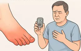 Biến chứng đa dây thần kinh ngoại biên do đái tháo đường có nguy hiểm không?