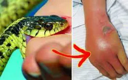 Cảnh báo tăng mạnh ca rắn cắn sau lũ