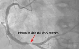 Cứu sống du khách nước ngoài bị sốc tim khi đang đi du lịch ở Quảng Ninh