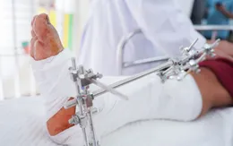 Nối thành công nhiều ca đứt lìa cổ bàn chân do máy cắt cỏ