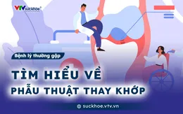 Tìm hiểu về phẫu thuật thay khớp
