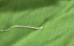 Hiếm gặp: Sán ký sinh trong khối u vùng ổ bụng