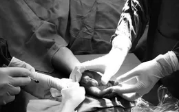 Điều trị thành công nhiễm trùng vết thương nặng bằng oxy cao áp