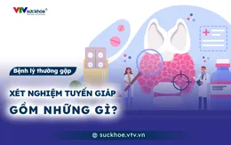 Xét nghiệm tuyến giáp gồm những gì?