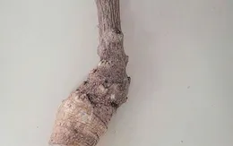 Cảnh báo ngộ độc, phản vệ nguy hiểm từ thực phẩm, rượu ngâm