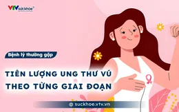 Tiên lượng ung thư vú theo từng giai đoạn