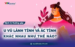 U vú lành tính và ác tính khác nhau như thế nào?