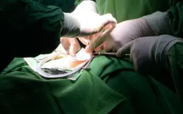 Sỏi đường tiết niệu ở trẻ em: Phát hiện muộn có thể gây suy thận