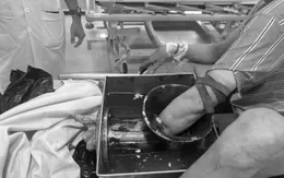 Tai nạn nghiêm trọng từ máy xay thịt: Cảnh báo an toàn lao động