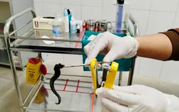 Phát hiện đỉa ký sinh trong mũi người bệnh