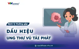 Dấu hiệu ung thư vú tái phát