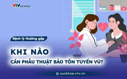 Khi nào cần phẫu thuật bảo tồn tuyến vú?