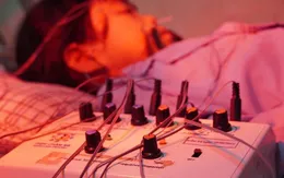 Cẩn trọng: Liệt dây thần kinh số VII do lạnh