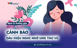 Cảnh báo dấu hiệu nghi ngờ ung thư vú