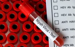 Virus Nipah là gì và vì sao được WHO xếp vào nhóm mầm bệnh ưu tiên?
