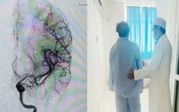 Cứu sống bệnh nhân đột quỵ não nhờ xử trí "giờ vàng"