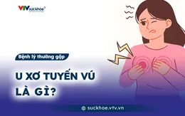 U xơ tuyến vú là gì?