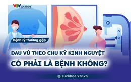 Đau vú theo chu kỳ kinh nguyệt có phải là bệnh không?