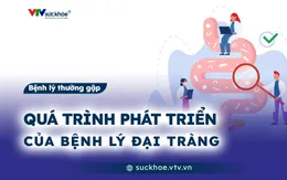 Quá trình phát triển của bệnh lý đại tràng